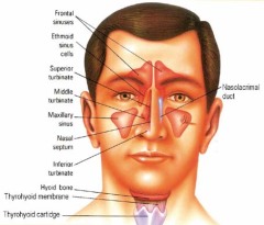 Sinus headaches generally affect the face and temple area